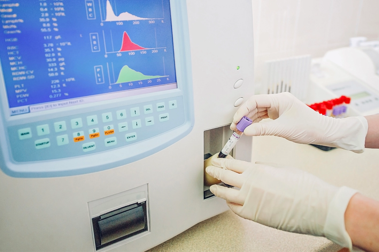 Self-Testing Provision for Medical Devices in China